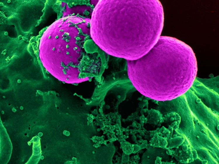 Amoeba bacteria climate change Pathogen risk rising?